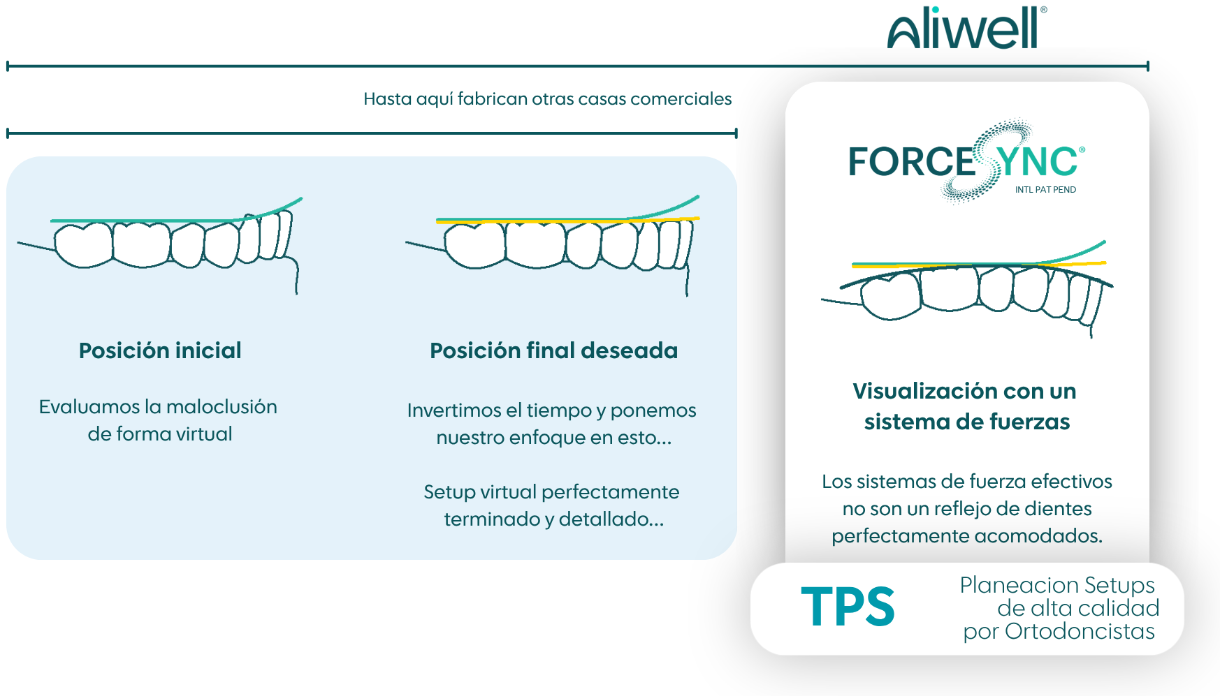 Comparación ForceSync vs otras casas comerciales