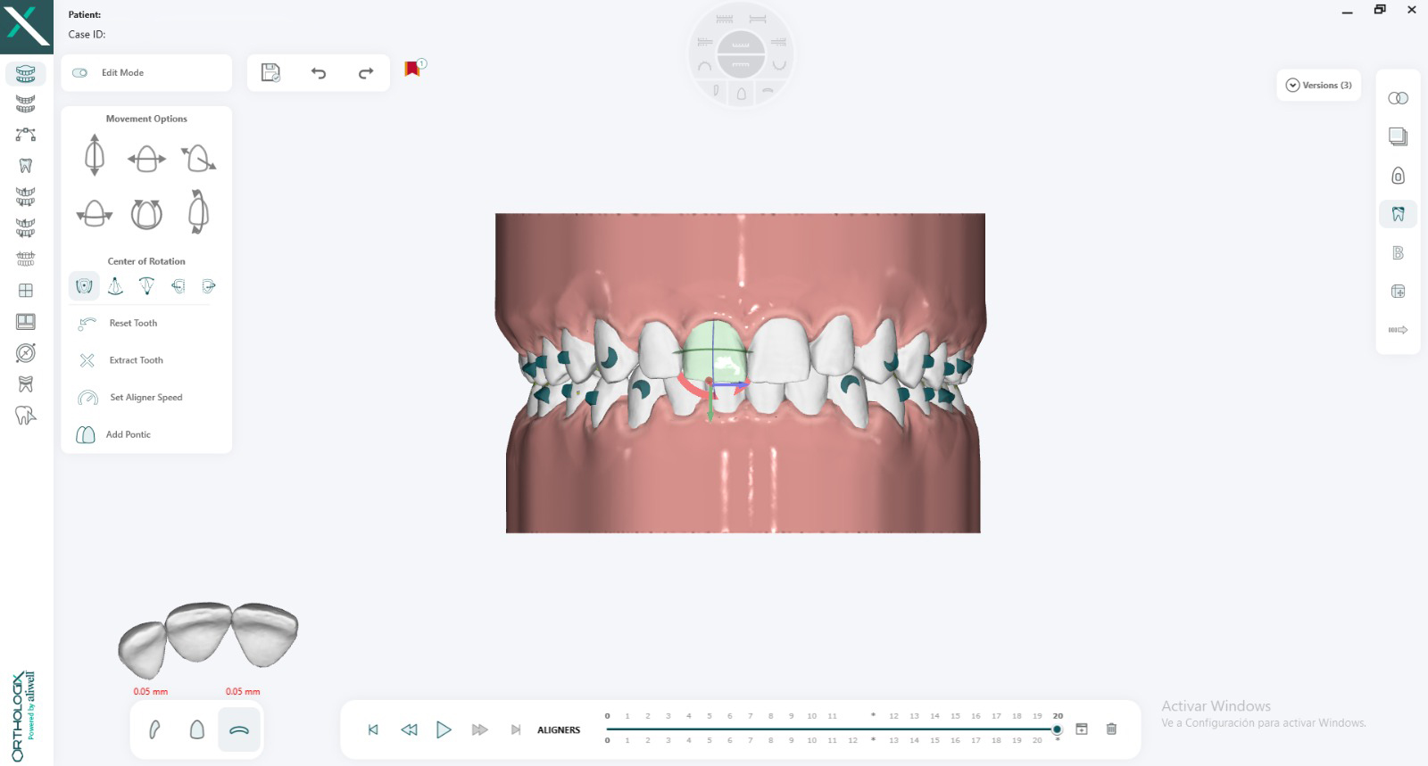 Vista del caso: arcadas superior e inferior en Orthologix