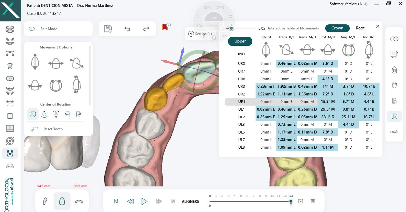Interfaz de planeación Orthologix mostrando movimientos dentales 3D