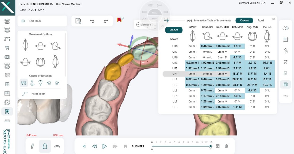 Tabla interactiva de movimientos en Orthologix
