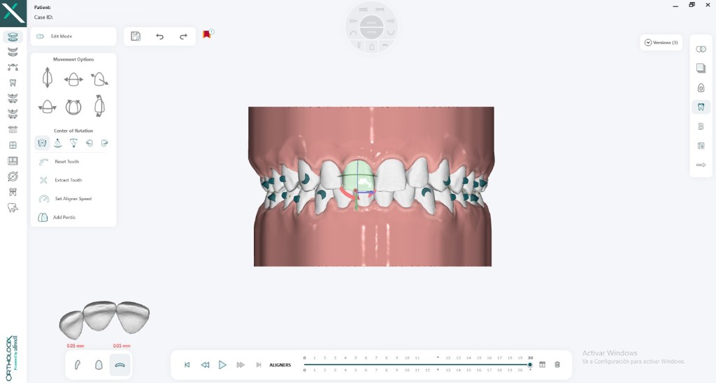 Herramienta de simetría y opciones de movimiento en Orthologix